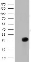 RIT2 / RIN Antibody - HEK293T cells were transfected with the pCMV6-ENTRY control (Left lane) or pCMV6-ENTRY RIT2 (Right lane) cDNA for 48 hrs and lysed. Equivalent amounts of cell lysates (5 ug per lane) were separated by SDS-PAGE and immunoblotted with anti-RIT2.