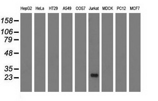 RIT2 / RIN Antibody - Western blot of extracts (35 ug) from 9 different cell lines by using anti-RIT2 monoclonal antibody.