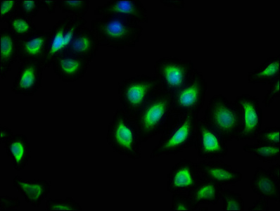 RIT2 / RIN Antibody - Immunofluorescence staining of A549 cells with RIT2 Antibody at 1:166, counter-stained with DAPI. The cells were fixed in 4% formaldehyde, permeabilized using 0.2% Triton X-100 and blocked in 10% normal Goat Serum. The cells were then incubated with the antibody overnight at 4°C. The secondary antibody was Alexa Fluor 488-congugated AffiniPure Goat Anti-Rabbit IgG(H+L).
