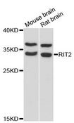 RIT2 / RIN Antibody - Western blot analysis of extracts of various cell lines, using RIT2 antibody at 1:3000 dilution. The secondary antibody used was an HRP Goat Anti-Rabbit IgG (H+L) at 1:10000 dilution. Lysates were loaded 25ug per lane and 3% nonfat dry milk in TBST was used for blocking. An ECL Kit was used for detection and the exposure time was 30s.