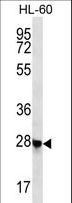 RITA1 / C12orf52 Antibody - CL052 Antibody western blot of HL-60 cell line lysates (35 ug/lane). The CL052 antibody detected the CL052 protein (arrow).