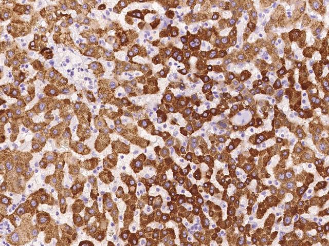 RITA1 / C12orf52 Antibody - Immunochemical staining of human RITA1 in human liver with rabbit polyclonal antibody at 1:100 dilution, formalin-fixed paraffin embedded sections.