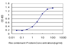 RLBP1 / CRALBP Antibody - Detection limit for recombinant GST tagged RLBP1 is approximately 0.3 ng/ml as a capture antibody.
