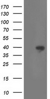 RLBP1 / CRALBP Antibody - HEK293T cells were transfected with the pCMV6-ENTRY control (Left lane) or pCMV6-ENTRY RLBP1 (Right lane) cDNA for 48 hrs and lysed. Equivalent amounts of cell lysates (5 ug per lane) were separated by SDS-PAGE and immunoblotted with anti-RLBP1.