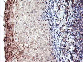 RLBP1 / CRALBP Antibody - IHC of paraffin-embedded Human tonsil using anti-RLBP1 mouse monoclonal antibody.