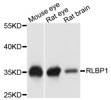 RLBP1 / CRALBP Antibody - Western blot analysis of extract of various cells.