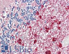 RLBP1 / CRALBP Antibody - Human Brain, Cerebellum: Formalin-Fixed, Paraffin-Embedded (FFPE)