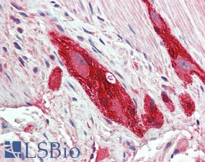 RLBP1 / CRALBP Antibody - Human Small Intestine, Myenteric Plexus: Formalin-Fixed, Paraffin-Embedded (FFPE)