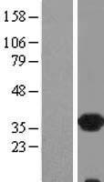 RLBP1 / CRALBP Protein - Western validation with an anti-DDK antibody * L: Control HEK293 lysate R: Over-expression lysate