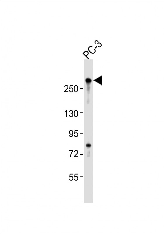 RLF Antibody - Anti-RLF Antibody (C-Term)at 1:2000 dilution + PC-3 whole cell lysates Lysates/proteins at 20 ug per lane. Secondary Goat Anti-Rabbit IgG, (H+L), Peroxidase conjugated at 1:10000 dilution. Predicted band size: 218 kDa. Blocking/Dilution buffer: 5% NFDM/TBST.