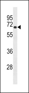 RLIM / RNF12 Antibody - RLIM Antibody western blot of HL-60 cell line lysates (35 ug/lane). The RLIM antibody detected the RLIM protein (arrow).