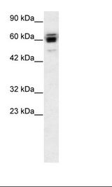 RLIM / RNF12 Antibody - Jurkat Cell Lysate.  This image was taken for the unconjugated form of this product. Other forms have not been tested.