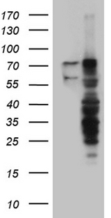 RLIM / RNF12 Antibody - HEK293T cells were transfected with the pCMV6-ENTRY control. (Left lane) or pCMV6-ENTRY RLIM. (Right lane) cDNA for 48 hrs and lysed. Equivalent amounts of cell lysates. (5 ug per lane) were separated by SDS-PAGE and immunoblotted with anti-RLIM. (1:2000)