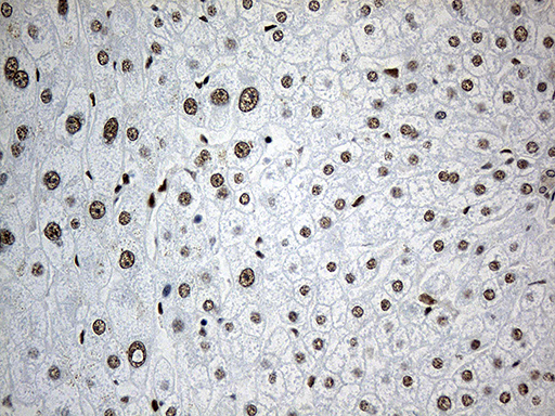 RLIM / RNF12 Antibody - Immunohistochemical staining of paraffin-embedded Human liver tissue within the normal limits using anti-RLIM mouse monoclonal antibody. (Heat-induced epitope retrieval by 1mM EDTA in 10mM Tris buffer. (pH8.5) at 120°C for 3 min. (1:500)