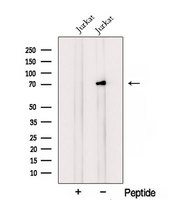 RLIM / RNF12 Antibody - Western blot analysis of extracts of HepG2 cells using RLIM antibody. The lane on the left was treated with blocking peptide.