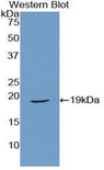RLN1 / Relaxin Antibody - Western blot of recombinant RLN1 / Relaxin.  This image was taken for the unconjugated form of this product. Other forms have not been tested.
