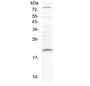 RLN1 / Relaxin Antibody - Western blot testing of rat PC-12 cell lysate with Relaxin antibody at 0.5ug/ml. Predicted molecular weight ~21 kDa.