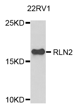 RLN2 / Relaxin 2 Antibody - Western blot analysis of extracts of 22RV1 cells.