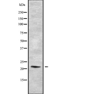 RLN2 / Relaxin 2 Antibody - Western blot analysis of RLN2 using HeLa whole cells lysates