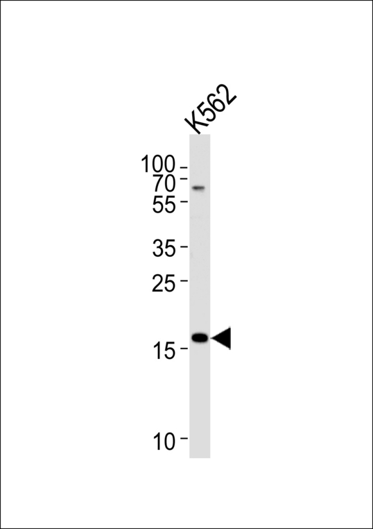 RMA1 / RNF5 Antibody - Western blot of lysate from K562 cell line, using RNF5 Antibody. Antibody was diluted at 1:1000 at each lane. A goat anti-rabbit IgG H&L (HRP) at 1:5000 dilution was used as the secondary antibody. Lysate at 35ug per lane.