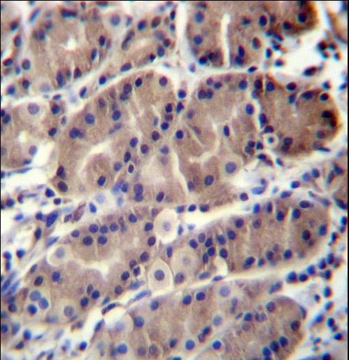 RMA1 / RNF5 Antibody - RNF5 Antibody immunohistochemistry of formalin-fixed and paraffin-embedded human stomach tissue followed by peroxidase-conjugated secondary antibody and DAB staining.