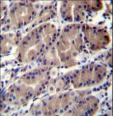RMA1 / RNF5 Antibody - RNF5 Antibody immunohistochemistry of formalin-fixed and paraffin-embedded human stomach tissue followed by peroxidase-conjugated secondary antibody and DAB staining.