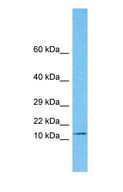 RMA1 / RNF5 Antibody - Western blot of RNF5 Antibody with human MDA-MB-435s Whole Cell lysate.  This image was taken for the unconjugated form of this product. Other forms have not been tested.