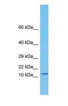 RMA1 / RNF5 Antibody - Western blot of RNF5 Antibody with human MDA-MB-435s Whole Cell lysate.  This image was taken for the unconjugated form of this product. Other forms have not been tested.
