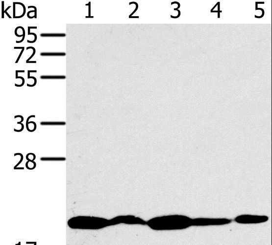 RMA1 / RNF5 Antibody - Western blot analysis of K562, 231, Jurkat, HeLa and 293T cell, using RNF5 Polyclonal Antibody at dilution of 1:200.
