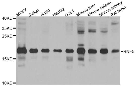 RMA1 / RNF5 Antibody - Western blot analysis of extracts of various cell lines.