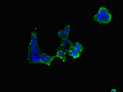 RMA1 / RNF5 Antibody - Immunofluorescent analysis of 293 cells diluted at 1:100 and Alexa Fluor 488-congugated AffiniPure Goat Anti-Rabbit IgG(H+L)
