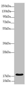 RMA1 / RNF5 Antibody - Western blot All Lanes:RNF5 antibody at 3.94 ug/ml+ Mouse gonadal tissue Secondary Goat polyclonal to rabbit IgG at 1/10000 dilution Predicted band size: 20 kDa Observed band size: 20 kDa