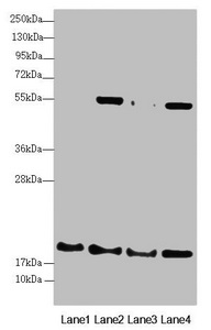 RMA1 / RNF5 Antibody - Western blot All Lanes:RNF5 antibody at 3.08 ug/ml Lane 1: A431 whole cell lysate Lane 2: Jurkat whole cell lysate Lane 3: Hela whole cell lysate Lane 4: HepG-2 whole cell lysate Secondary Goat polyclonal to rabbit IgG at 1/10000 dilution Predicted band size: 20 kDa Observed band size: 20,55 kDa