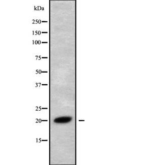 RMA1 / RNF5 Antibody - Western blot analysis of RNF5 using Jurkat whole cells lysates