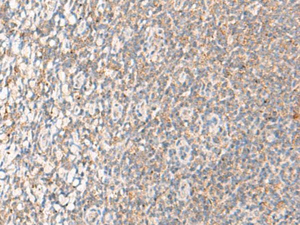 RMA1 / RNF5 Antibody - Immunohistochemistry of paraffin-embedded Human tonsil tissue  using RNF5 Polyclonal Antibody at dilution of 1:40(×200)