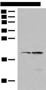 RMA1 / RNF5 Antibody - Western blot analysis of 293T and Jurkat cell lysates  using RNF5 Polyclonal Antibody at dilution of 1:250