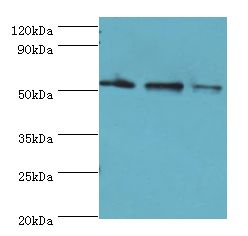 RMDN3 Antibody - Western blot. All lanes: RMDN3 antibody at 4 ug/ml <br/>. Lane 1: HeLa whole cell lysate<br/>. Lane 2: MCF-7 whole cell lysate<br/>. Lane 3: mouse liver tissue <br/>. secondary <br/> Goat polyclonal to rabbit at 1:10000 dilution <br/>. Predicted band size: 52 kDa <br/>. Observed band size: 52 kDa.