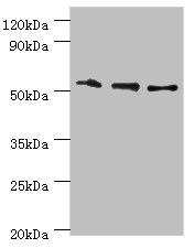 RMDN3 Antibody - Western blot All lanes: RMDN3 antibody at 4µg/ml Lane 1: Hela whole cell lysate Lane 2: MCF-7 whole cell lysate Lane 3: Mouse liver tissue Secondary Goat polyclonal to rabbit IgG at 1/10000 dilution Predicted band size: 53, 39 kDa Observed band size: 53 kDa