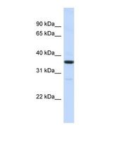 RMDN3 Antibody - Western blot of Human HepG2. RMDN3 antibody dilution 1.0 ug/ml.  This image was taken for the unconjugated form of this product. Other forms have not been tested.
