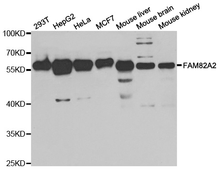 RMDN3 Antibody - Western blot analysis of extracts of various cells.