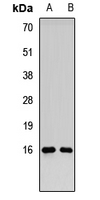 RMI2 / C16orf75 Antibody
