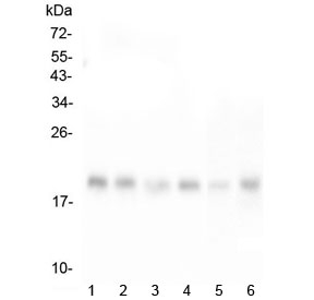 RMI2 / C16orf75 Antibody - Western blot testing of human 1) HeLa, 2) T-47D, 3) HepG2, 4) K562, 5) mouse liver and 6) mouse HEPA1-6 lysate with RMI2 antibody at 0.5ug/ml. Expected molecular weight ~18 kDa.