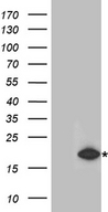 RMI2 / C16orf75 Antibody - HEK293T cells were transfected with the pCMV6-ENTRY control. (Left lane) or pCMV6-ENTRY RMI2. (Right lane) cDNA for 48 hrs and lysed
