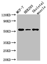 RMND1 Antibody - Positive WB detected in:MCF-7 whole cell lysate,HEK293 whole cell lysate,Mouse skeletal muscle tissue;All lanes:RMND1 antibody at 3?g/ml;Secondary;Goat polyclonal to rabbit IgG at 1/50000 dilution;predicted band size: 52,28,24 kDa;observed band size: 52 kDa;