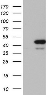 RMND5A Antibody - HEK293T cells were transfected with the pCMV6-ENTRY control (Left lane) or pCMV6-ENTRY RMND5A (Right lane) cDNA for 48 hrs and lysed. Equivalent amounts of cell lysates (5 ug per lane) were separated by SDS-PAGE and immunoblotted with anti-RMND5A.