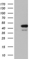 RMND5A Antibody - HEK293T cells were transfected with the pCMV6-ENTRY control (Left lane) or pCMV6-ENTRY RMND5A (Right lane) cDNA for 48 hrs and lysed. Equivalent amounts of cell lysates (5 ug per lane) were separated by SDS-PAGE and immunoblotted with anti-RMND5A.