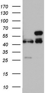 RMND5A Antibody - HEK293T cells were transfected with the pCMV6-ENTRY control (Left lane) or pCMV6-ENTRY RMND5A (Right lane) cDNA for 48 hrs and lysed. Equivalent amounts of cell lysates (5 ug per lane) were separated by SDS-PAGE and immunoblotted with anti-RMND5A.