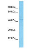 RMND5A Antibody - RMD5 / FLJ13910 antibody Western Blot of PANC1. Antibody dilution: 1 ug/ml.  This image was taken for the unconjugated form of this product. Other forms have not been tested.