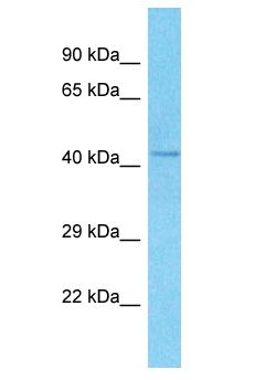 RMND5A Antibody - RMD5 / FLJ13910 antibody Western Blot of PANC1. Antibody dilution: 1 ug/ml.  This image was taken for the unconjugated form of this product. Other forms have not been tested.