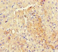 RMND5A Antibody - Immunohistochemistry of paraffin-embedded human liver tissue using RMND5A Antibody at dilution of 1:100